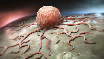 foto cellula tumorale