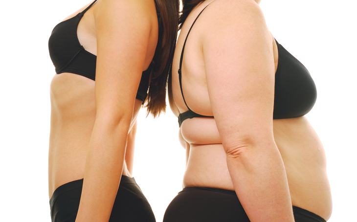 Diagnosi, cura e prevenzione dell’obesità