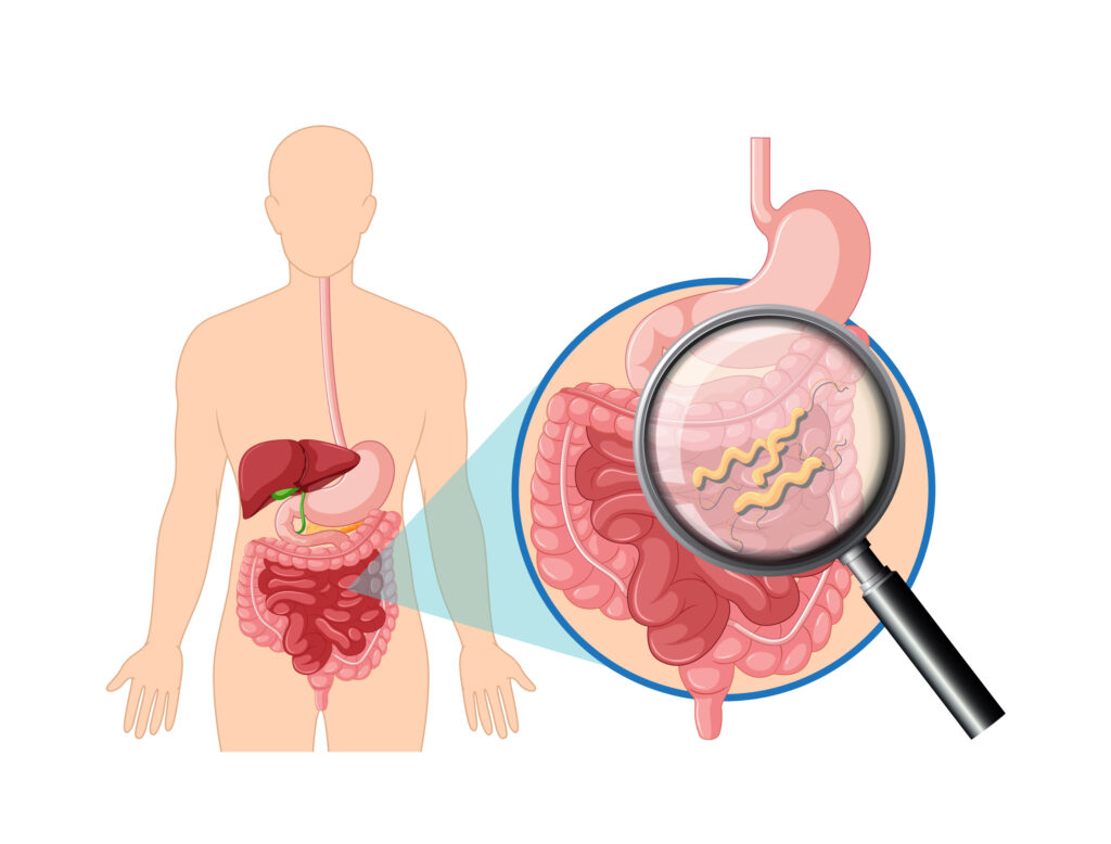 Gastroenterite: sintomi, cause e come affrontarla